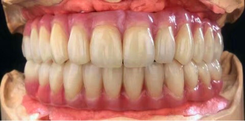 Des crowns et des ponts à dents en céramique de zirconium