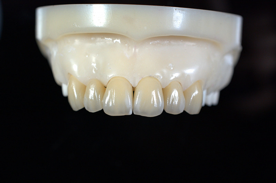 Laboratoire dentaire sur mesure pour les prothèses dentaires en zirconium - Livraison rapide et réparation
