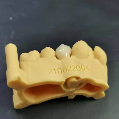conception numérique + impression de modèle + couronne de zirconia