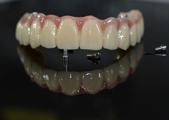 Couronne dentaire en zirconium: dents d'aspect naturel, durables et sûres