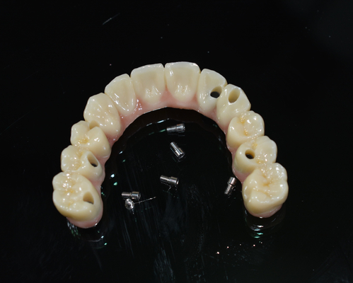 Couronne dentaire en zirconium: dents d'aspect naturel, durables et sûres