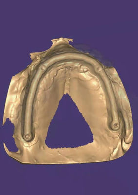 Une couronne en zirconium 3D personnalisée offrant une durabilité durable conçue pour répondre aux besoins des professionnels dentaires et des laboratoires