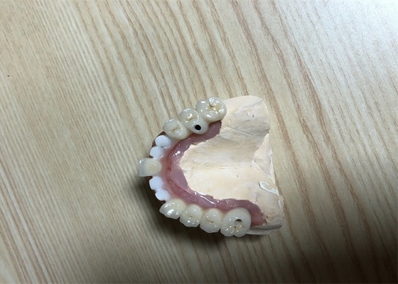Couronne précise d'implant de dent d'attachements d'implant dentaire de Biocompatibility
