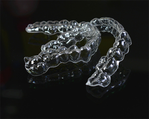 Appareils d'orthodontie fixes et invisibles simples à installer pour les études chez le dentiste