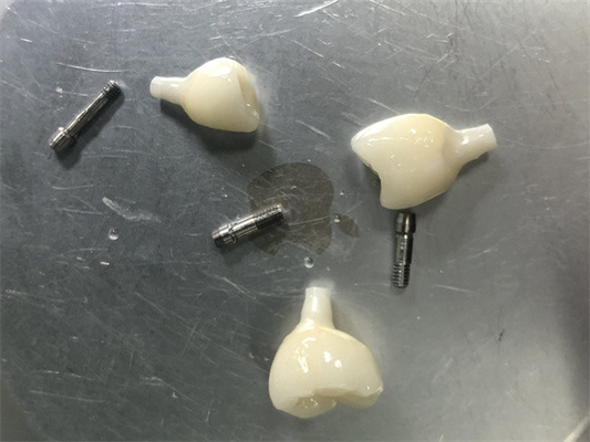 Restauration de l' implant de zirconia Aucun problème de couleur