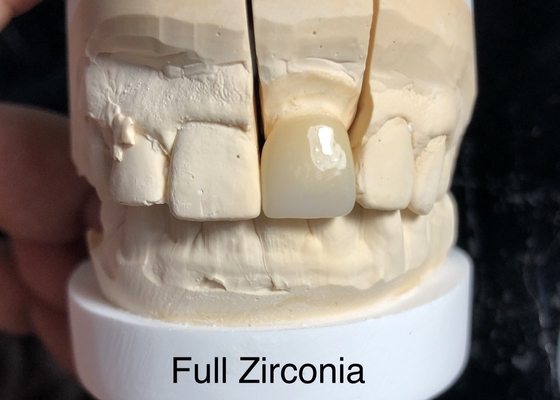 3D multi-niveaux Zirconia à contour complet Résoudre le problème de l'absence de transparence