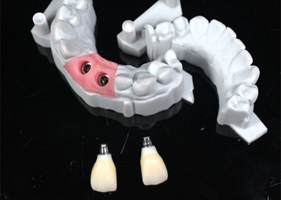 Conception CAD/CAM précise de couronne dentaire en zirconium pour l'ajustement