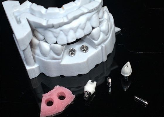 Modèle 3D Couronne de zirconium