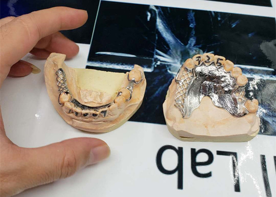CAD-CAM de grande précision a fixé la conception démontable de numérisation de pont