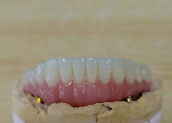 La couronne en zirconium avec dentition implantée pour laboratoire dentaire