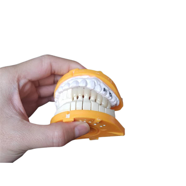 Couronnes en céramique faites sur commande de la taille PFM pour les dents postérieures et antérieures