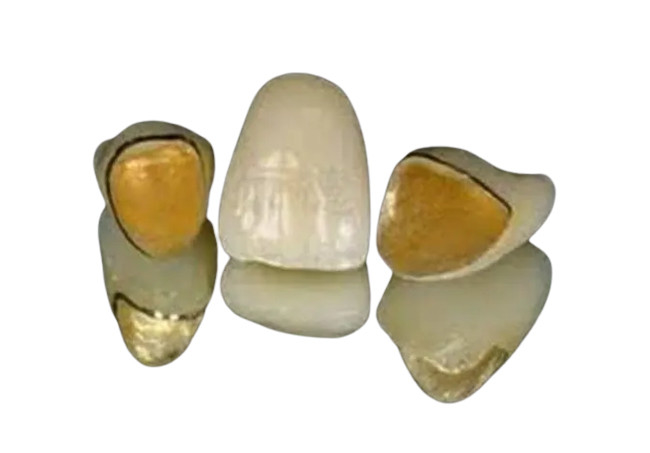 Conception réaliste de numérisation de couleur de PFM en métal de dents extérieures lisses de porcelaine