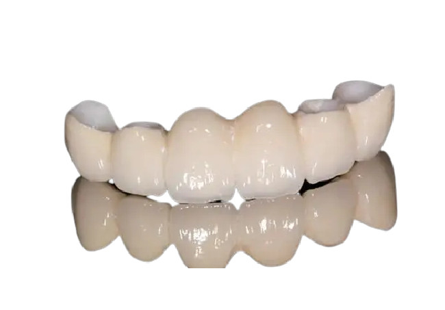 Aspect naturel de couronne dentaire anticorrosion de porcelaine pour Front Teeth/dents arrières