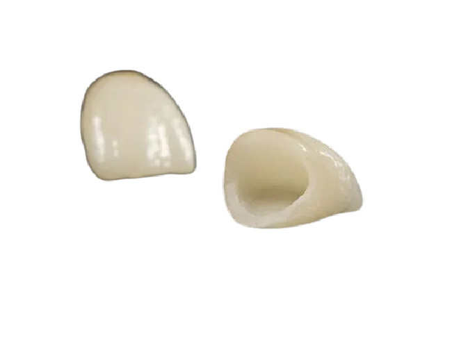 Taille adaptée aux besoins du client par couleurs réalistes dentaires en céramique fortement biocompatibles de couronne belles