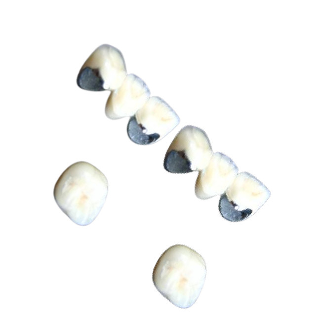 Dents dentaires de porcelaine de Chrome de cobalt de couronne de porcelaine non allergique anticorrosion