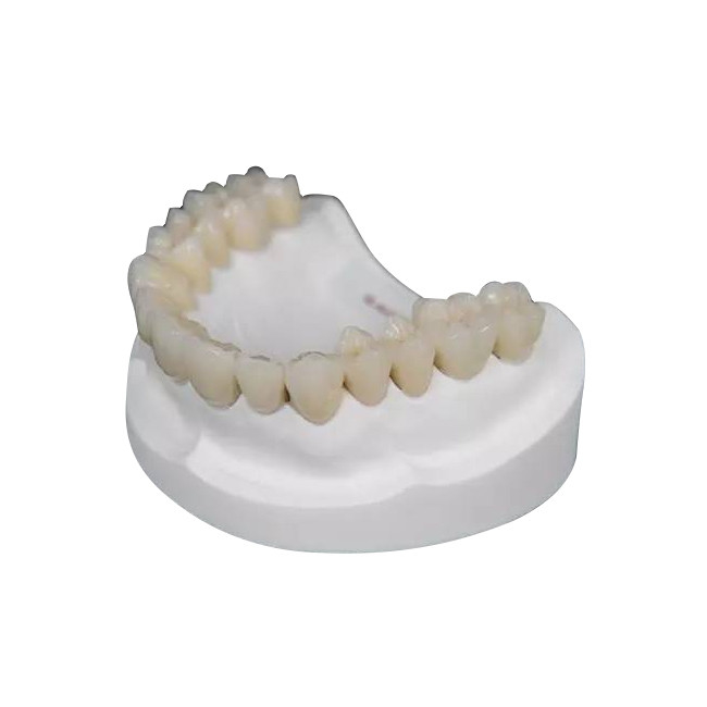 Couronne durable de bioxyde de zirconium aucune odeur aucune corrosion aucune irritation pour réduire en pulpe des nerfs