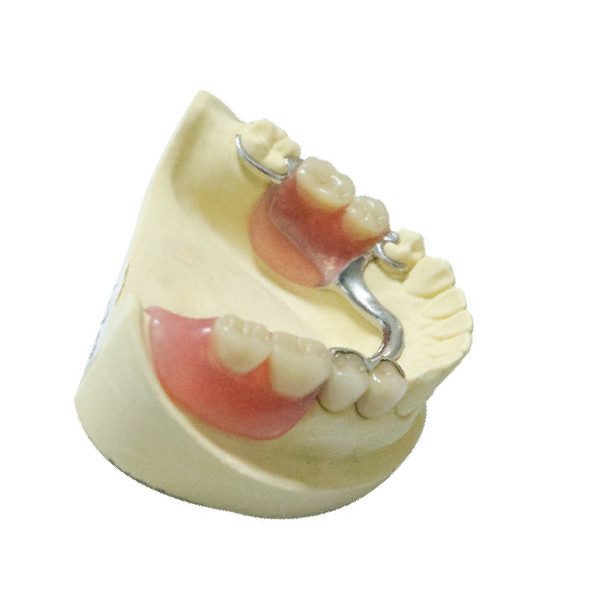 Produits dentaires de laboratoire de dentiers de restauration partielle démontable en acier de dentier