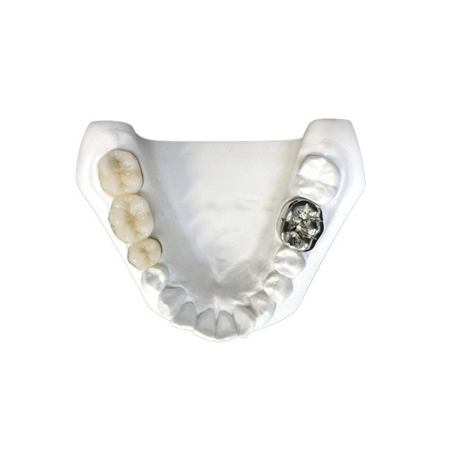 La couleur de la couronne de porcelaine est Stablenot et a la stabilité forte