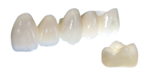Les couronnes de porcelaine sont belles dans la forme réaliste en couleurs et forte dans la stabilité