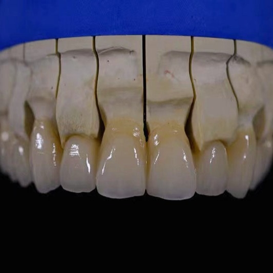 Zirconium pour la restauration des ponts de zirconium blanc Matériau de porcelaine: Vita VM9 poudre de porcelaine
